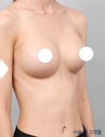 DA Plastic Surgery, Reviews, Images, Promotions — Korea cost, reviews & before-after | MISOODA