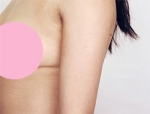 Faceline Plastic Surgery, Reviews,Images,Promotions — Korea cost, reviews & before-after | MISOODA