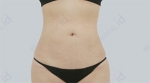 ID Plastic Surgery , Reviews, Images, Promotions — Korea cost, reviews & before-after | MISOODA