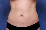 Deesse Plastic Surgery, Reviews,Images, Promotions — Korea cost, reviews & before-after | MISOODA