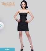 Theline Plastic Surgery,Reviews,Images, Promotions — Korea cost, reviews & before-after | MISOODA