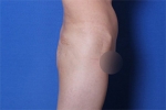 Deesse Plastic Surgery, Reviews,Images, Promotions — Korea cost, reviews & before-after | MISOODA