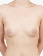 View Plastic Surgery, Reviews, Images, Promotions — Korea cost, reviews & before-after | MISOODA