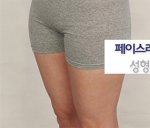 Faceline Plastic Surgery, Reviews,Images,Promotions — Korea cost, reviews & before-after | MISOODA