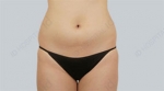 ID Plastic Surgery , Reviews, Images, Promotions — Korea cost, reviews & before-after | MISOODA