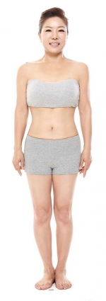 liposuction