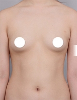 DA Plastic Surgery, Reviews, Images, Promotions — Korea cost, reviews & before-after | MISOODA