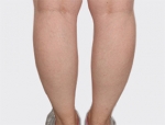 Faceline Plastic Surgery, Reviews,Images,Promotions — Korea cost, reviews & before-after | MISOODA