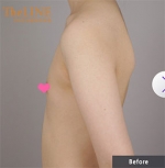 Theline Plastic Surgery,Reviews,Images, Promotions — Korea cost, reviews & before-after | MISOODA