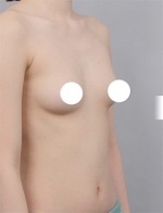 DA Plastic Surgery, Reviews, Images, Promotions — Korea cost, reviews & before-after | MISOODA