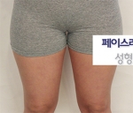 Faceline Plastic Surgery, Reviews,Images,Promotions — Korea cost, reviews & before-after | MISOODA