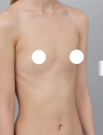 DA Plastic Surgery, Reviews, Images, Promotions — Korea cost, reviews & before-after | MISOODA