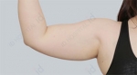 ID Plastic Surgery , Reviews, Images, Promotions — Korea cost, reviews & before-after | MISOODA