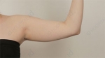ID Plastic Surgery , Reviews, Images, Promotions — Korea cost, reviews & before-after | MISOODA