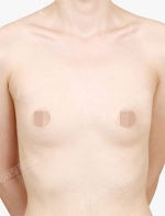 View Plastic Surgery, Reviews, Images, Promotions — Korea cost, reviews & before-after | MISOODA