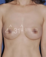 April 31 Plastic Surgery,Reviews,Images,Promotions — Korea cost, reviews & before-after | MISOODA