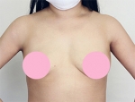 Faceline Plastic Surgery, Reviews,Images,Promotions — Korea cost, reviews & before-after | MISOODA