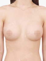 View Plastic Surgery, Reviews, Images, Promotions — Korea cost, reviews & before-after | MISOODA