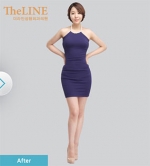 Theline Plastic Surgery,Reviews,Images, Promotions — Korea cost, reviews & before-after | MISOODA