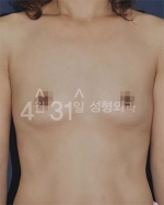 April 31 Plastic Surgery,Reviews,Images,Promotions — Korea cost, reviews & before-after | MISOODA
