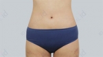 ID Plastic Surgery , Reviews, Images, Promotions — Korea cost, reviews & before-after | MISOODA