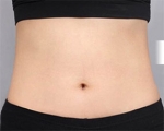 DA Plastic Surgery, Reviews, Images, Promotions — Korea cost, reviews & before-after | MISOODA