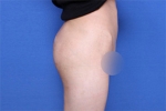 Deesse Plastic Surgery, Reviews,Images, Promotions — Korea cost, reviews & before-after | MISOODA