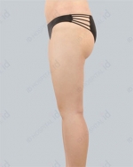 ID Plastic Surgery , Reviews, Images, Promotions — Korea cost, reviews & before-after | MISOODA