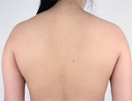 Faceline Plastic Surgery, Reviews,Images,Promotions — Korea cost, reviews & before-after | MISOODA