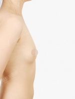 View Plastic Surgery, Reviews, Images, Promotions — Korea cost, reviews & before-after | MISOODA