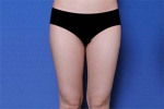 Deesse Plastic Surgery, Reviews,Images, Promotions — Korea cost, reviews & before-after | MISOODA