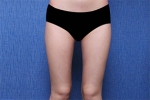 Deesse Plastic Surgery, Reviews,Images, Promotions — Korea cost, reviews & before-after | MISOODA