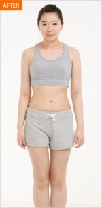 Banobagi Plastic Surgery,Reviews,Images, Promotions, MISOODA — Korea cost, reviews & before-after | MISOODA