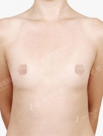 View Plastic Surgery, Reviews, Images, Promotions — Korea cost, reviews & before-after | MISOODA