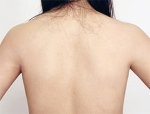 Faceline Plastic Surgery, Reviews,Images,Promotions — Korea cost, reviews & before-after | MISOODA