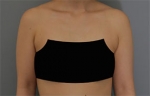 Rovl Avenue Liposuction,Reviews,Images, Promotions — Korea cost, reviews & before-after | MISOODA