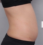DA Plastic Surgery, Reviews, Images, Promotions — Korea cost, reviews & before-after | MISOODA