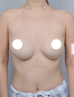 DA Plastic Surgery, Reviews, Images, Promotions — Korea cost, reviews & before-after | MISOODA