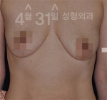 April 31 Plastic Surgery,Reviews,Images,Promotions — Korea cost, reviews & before-after | MISOODA