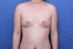 Deesse Plastic Surgery, Reviews,Images, Promotions — Korea cost, reviews & before-after | MISOODA