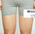 Faceline Plastic Surgery, Reviews,Images,Promotions — Korea cost, reviews & before-after | MISOODA