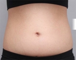 DA Plastic Surgery, Reviews, Images, Promotions — Korea cost, reviews & before-after | MISOODA