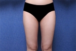 Deesse Plastic Surgery, Reviews,Images, Promotions — Korea cost, reviews & before-after | MISOODA