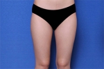 Deesse Plastic Surgery, Reviews,Images, Promotions — Korea cost, reviews & before-after | MISOODA