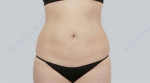 ID Plastic Surgery , Reviews, Images, Promotions — Korea cost, reviews & before-after | MISOODA