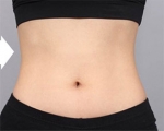 DA Plastic Surgery, Reviews, Images, Promotions — Korea cost, reviews & before-after | MISOODA