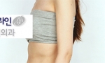 Faceline Plastic Surgery, Reviews,Images,Promotions — Korea cost, reviews & before-after | MISOODA