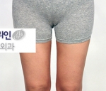 Faceline Plastic Surgery, Reviews,Images,Promotions — Korea cost, reviews & before-after | MISOODA