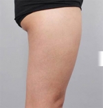 DA Plastic Surgery, Reviews, Images, Promotions — Korea cost, reviews & before-after | MISOODA