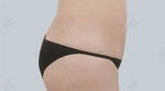 ID Plastic Surgery , Reviews, Images, Promotions — Korea cost, reviews & before-after | MISOODA
